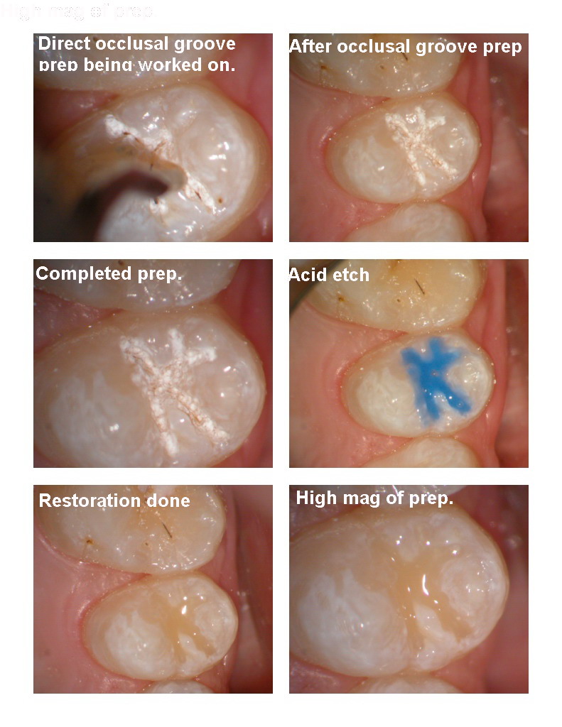 Colonna technique pg 2.jpg